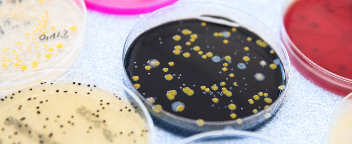 Microbiology: A system for greater product safety