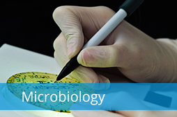 Microbiology analytics